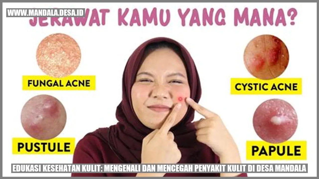 Edukasi Kesehatan Kulit: Mengenali dan Mencegah Penyakit Kulit di Desa Mandala
