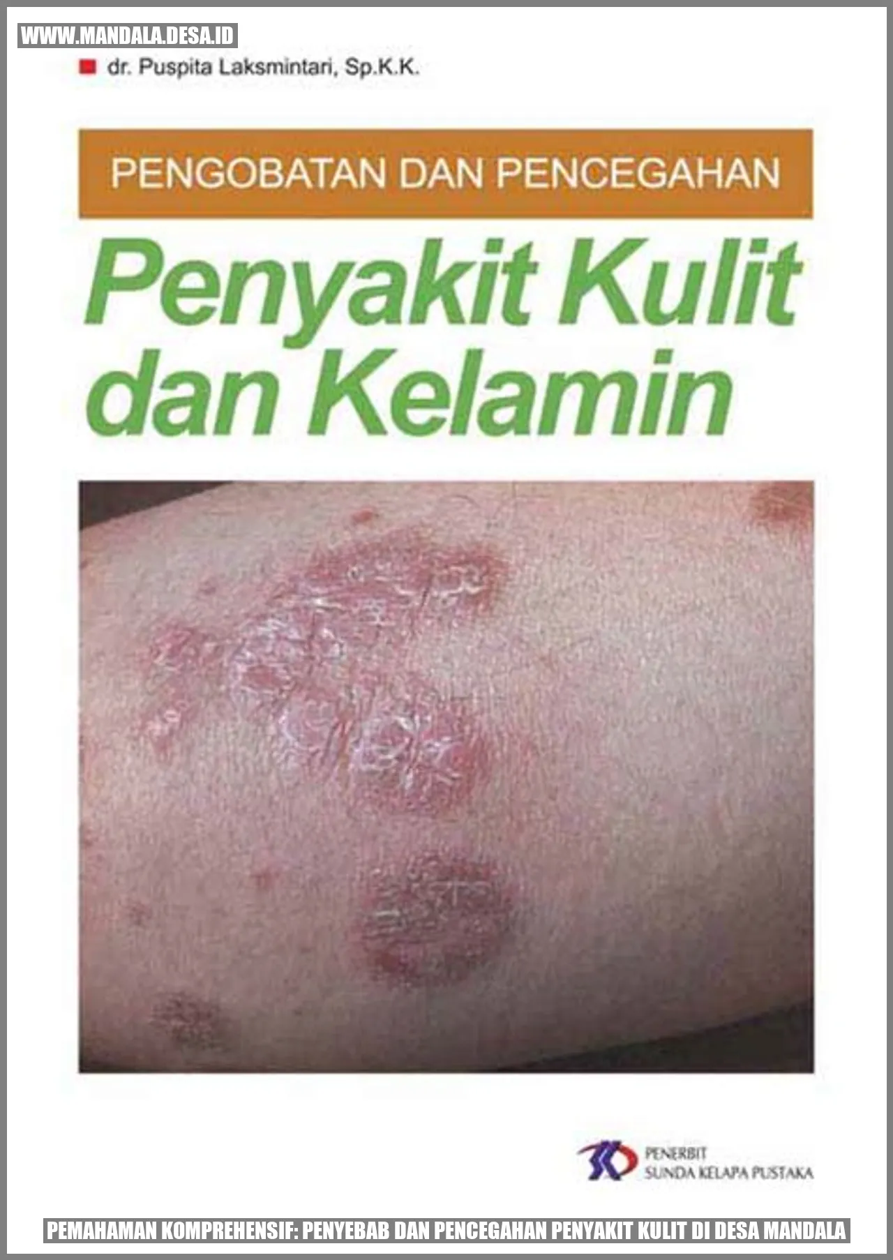 Pemahaman Komprehensif: Penyebab dan Pencegahan Penyakit Kulit di Desa Mandala