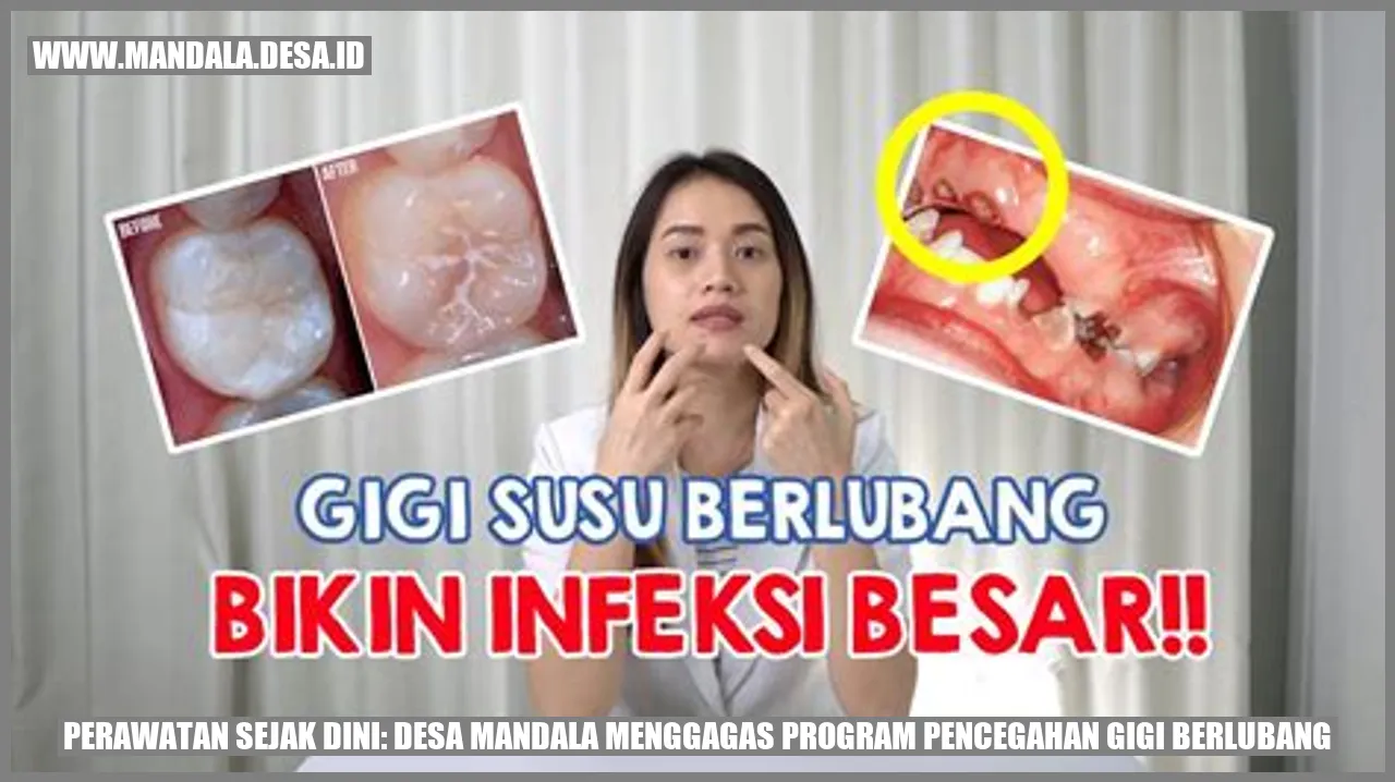 Desa Mandala Menggagas Program Pencegahan Gigi Berlubang